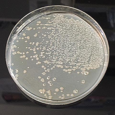細菌のコロニー