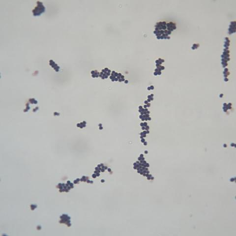 グラム陽性球菌